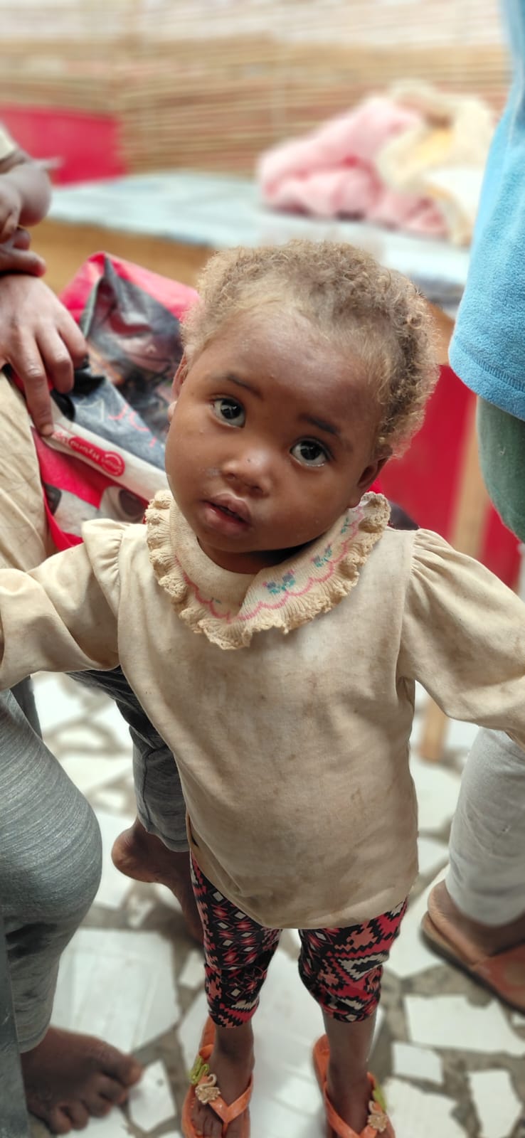 Ivandry area baby at a RZT nutritional screening event